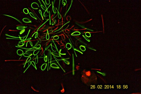 Spermatidi in evoluzione - Rossi maturi - Verdi Giovani - Dimidio Bromuro Isotiocianato di Fluoresceina
